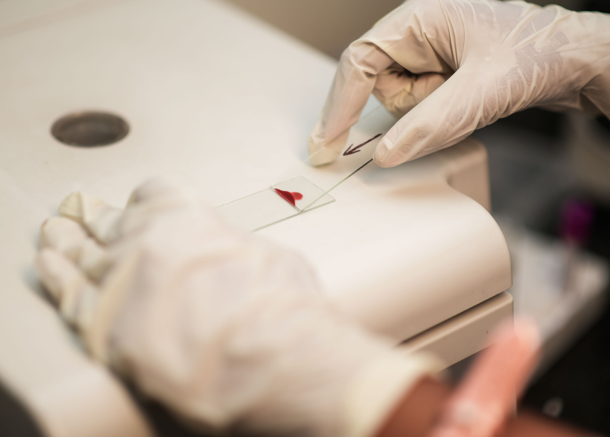 blood samples